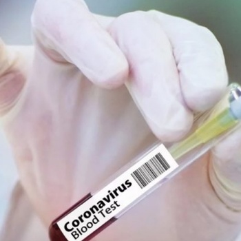 ¿Una cura?:  Israel anuncia que podría tener la vacuna contra el coronavirus en junio