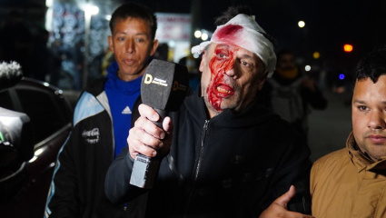 Atacaron brutalmente a un periodista en el acto de Milei: de los agravios presidenciales a la violencia física