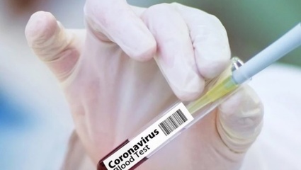 ¿Una cura?:  Israel anuncia que podría tener la vacuna contra el coronavirus en junio