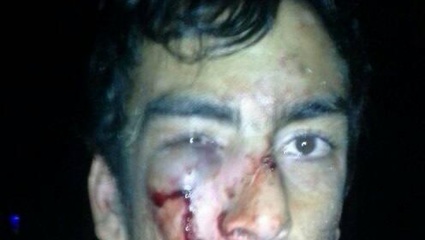 Carnaval en "la Repu": denuncian que un hombre fue golpeado brutalmente por agentes municipales